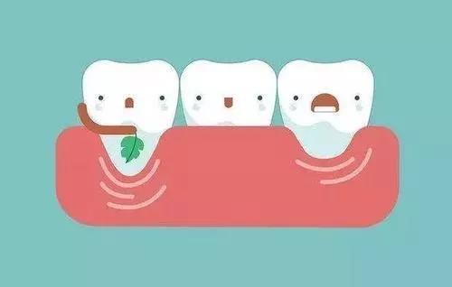有一种痛，叫——经常塞牙
